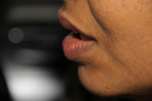 Lippenfalten Serum